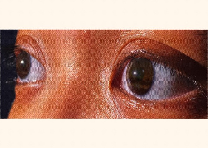 Close up of a human face